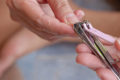How to Cut Your Nails Properly to Prevent Infection